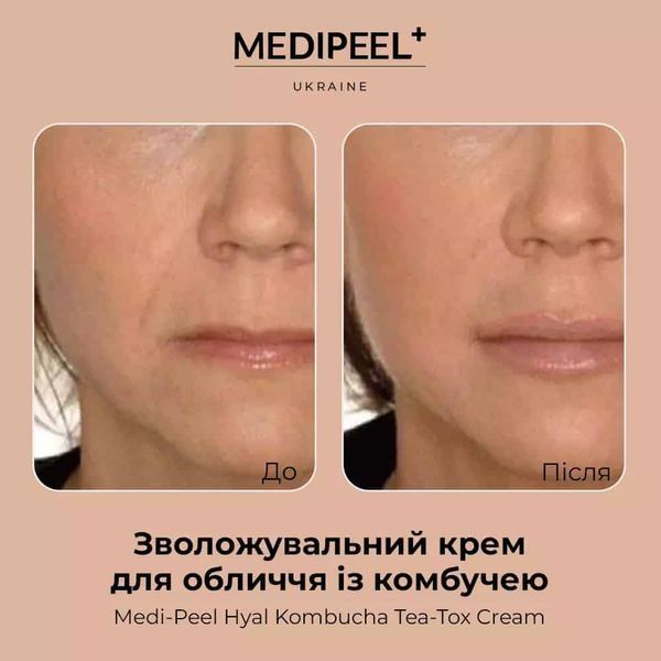 Зволожувальний крем для обличчя із комбучею MEDIPEEL Hyal Kombucha Tea-Tox Cream, 50 мл MPB0198A фото